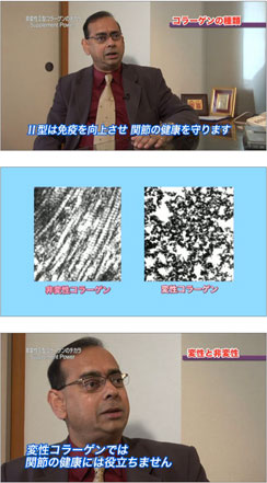 非変性コラーゲン